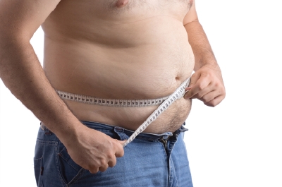 Man with high bmi and excess belly fat